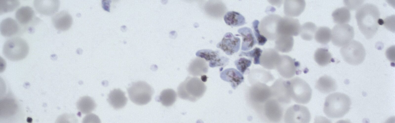 Exflagellating Giemsa stained male